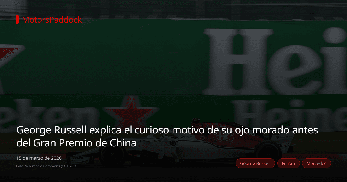 George Russell explica el curioso motivo de su ojo morado antes del Gran Premio de China