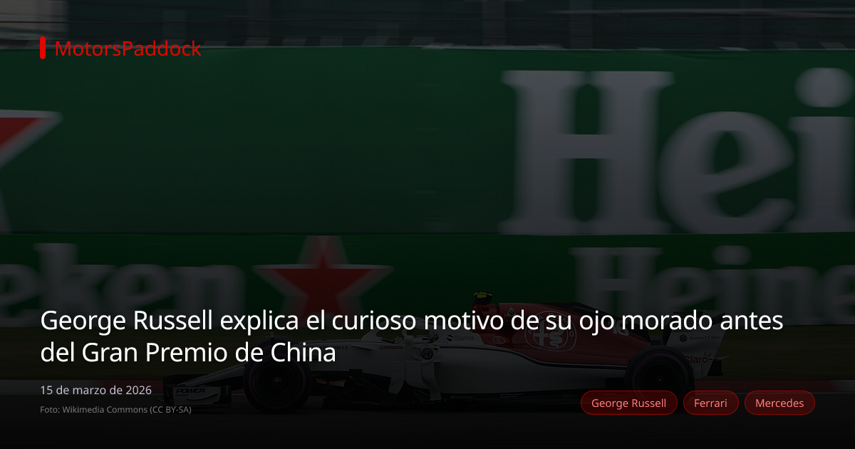 George Russell explica el curioso motivo de su ojo morado antes del Gran Premio de China